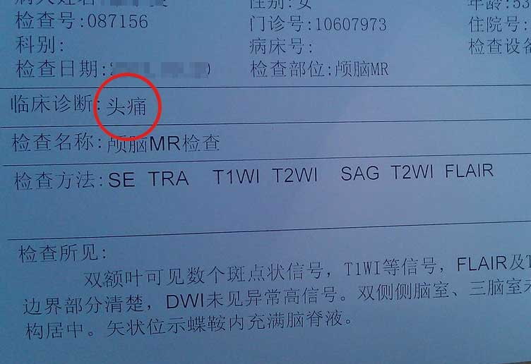 偏头痛医院